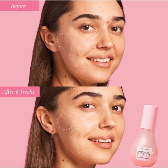 🍉 GLOW RECIPE Watermelon Glow Niacinamide Dew Drops Serum - Picture 6 of 7